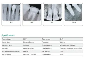 Zobni Prenosni X Ray Enote/Visoko Frekvenco Prenosni dental X-Ray pralni/Dental imaging sistem prenosni x ray stroj